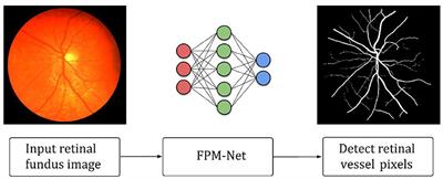 Feature preserving mesh network for semantic segmentation of retinal vasculature to support ophthalmic disease analysis